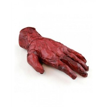 Burnt Hand